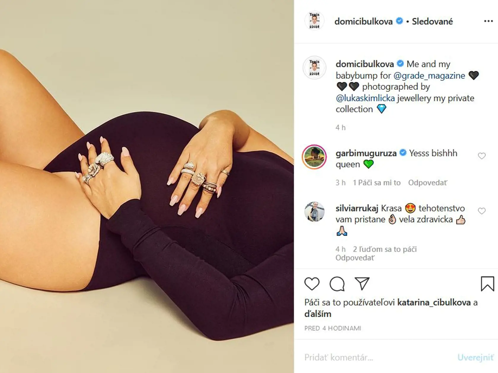 Cibulková zverejnila niekoľko záberov pre módny magazín a fanúšikovia jej za ne poriadne naložili.