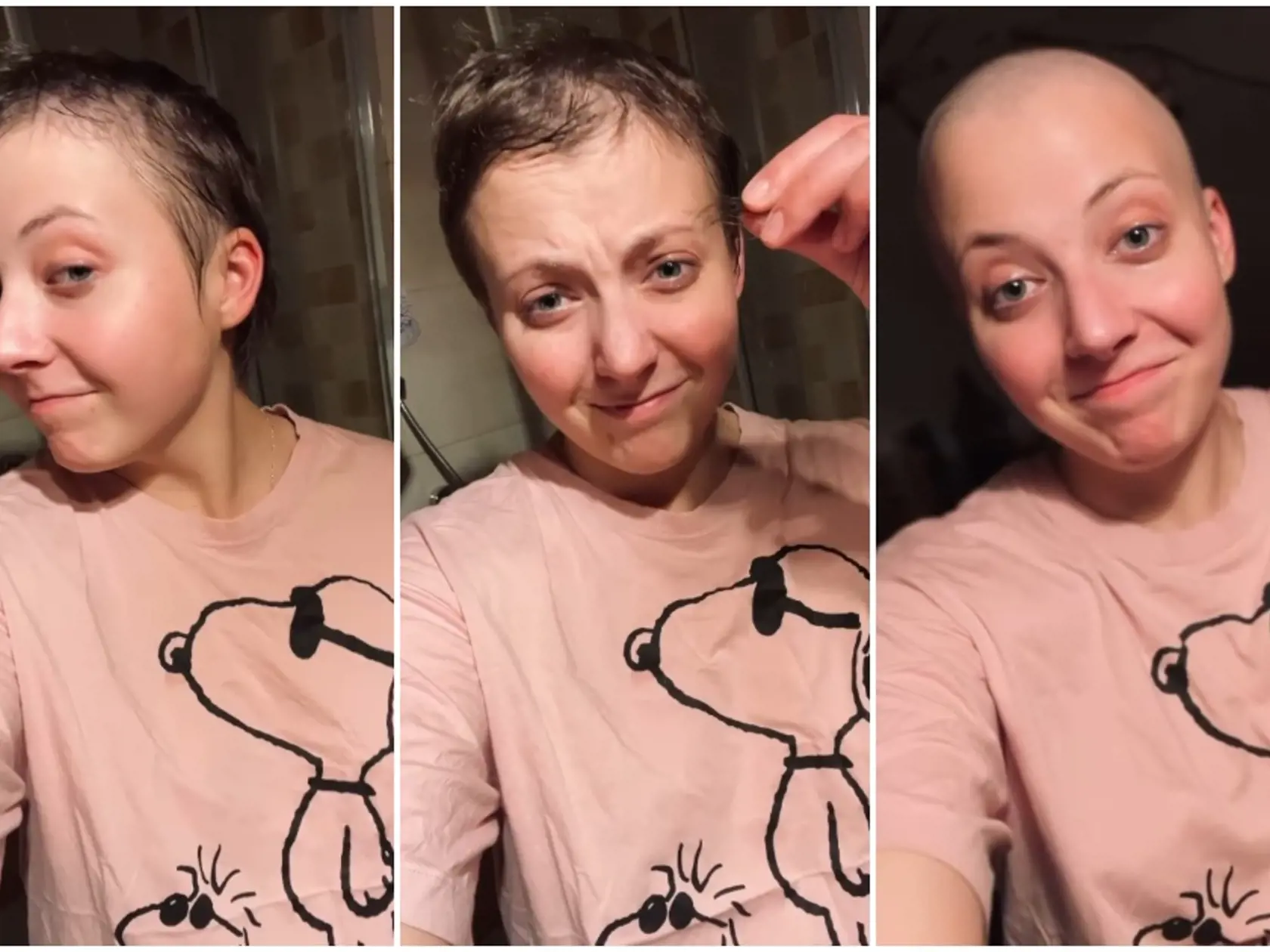 Anna Slováčková si znovu oholila hlavu. 