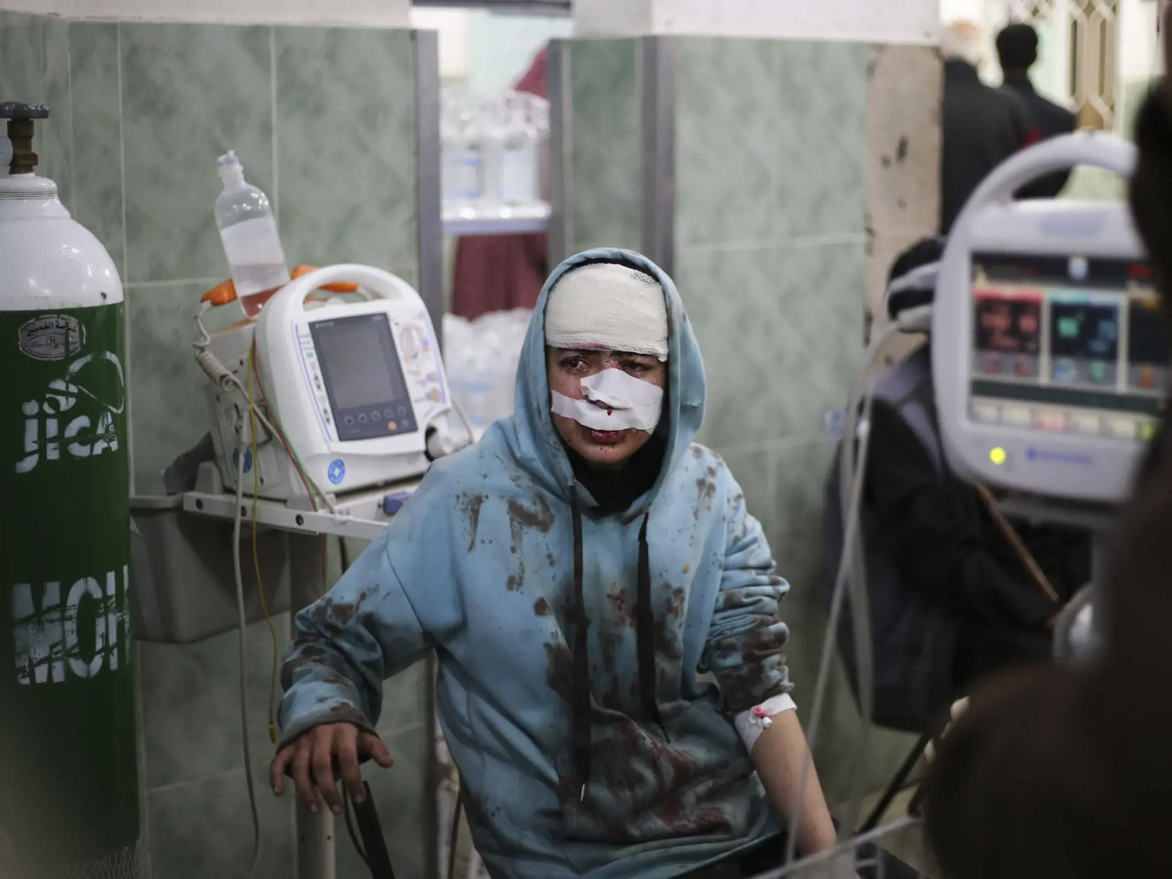 KK88 Rafah - Palestínčanka sedí zranená na posteli v nemocnici v meste Rafah na juhu Pásma Gazy 10. februára 2024. Palestínske hnutie Hamas v nedeľu upozornilo Izrael, že spustením vojenskej operácie v meste Rafah na juhu Pásma Gazy ohrozí rokovania o prepustení rukojemníkov, ktorých militanti zajali pri útoku na Izrael zo 7. októbra. FOTO TASR/AP
A Palestinian wounded in the Israeli bombardment sits in a hospital In Rafah, Gaza Strip, Saturday, Feb. 10, 2024. (AP Photo/Hatem Ali)