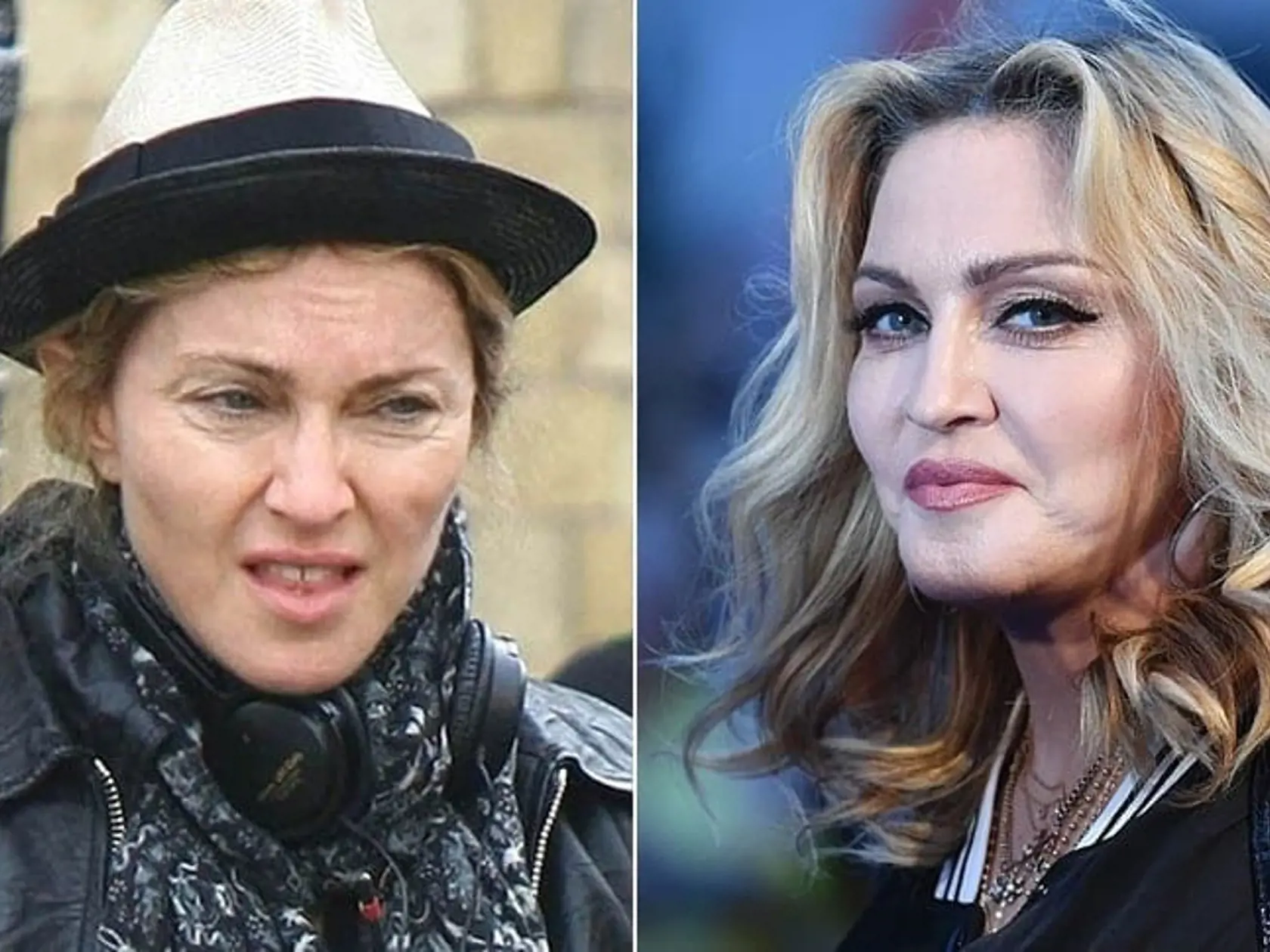 Fotka Madony z čias, keď ešte starla prirodzenou cestou. Dnes k mejkapu pridala botox a tak sa rozhodla z prirodzenosti prejsť na overený recept na vrásky.