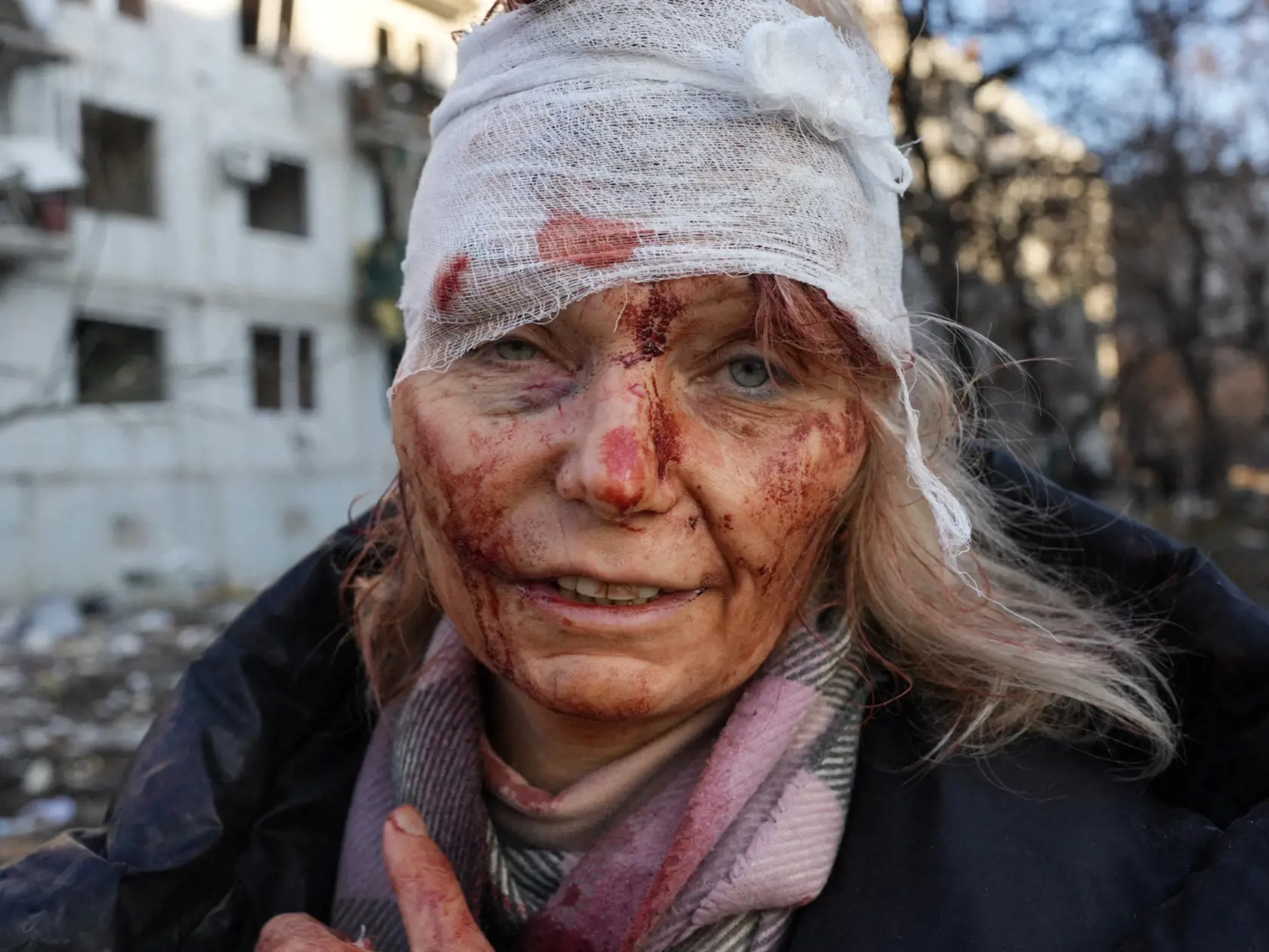 Učiteľka OLENA KURILOVÁ unikla smrti len o vlások, keď rakety zasiahli jej domov.