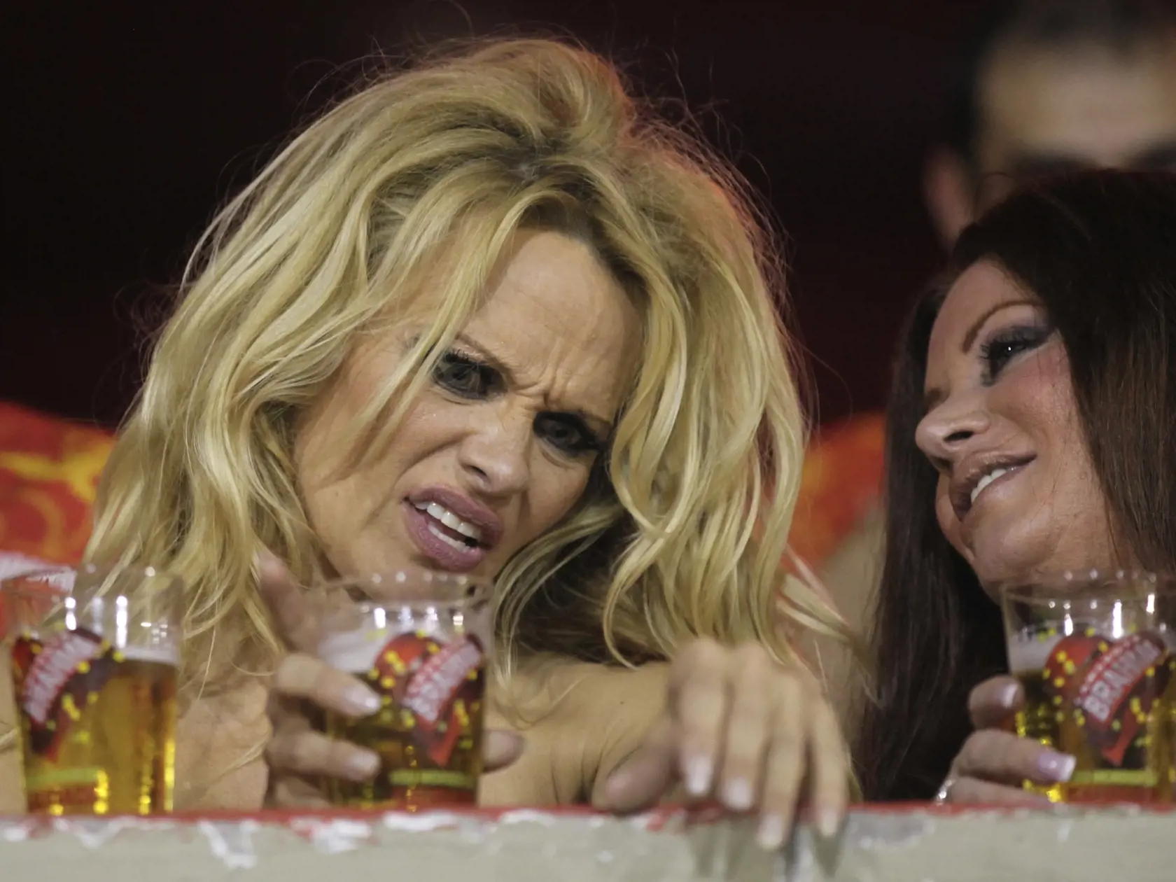 Prominentná pacientka: Americká herečka Pamela Anderson sa tiež liečila na hepatitídu C.