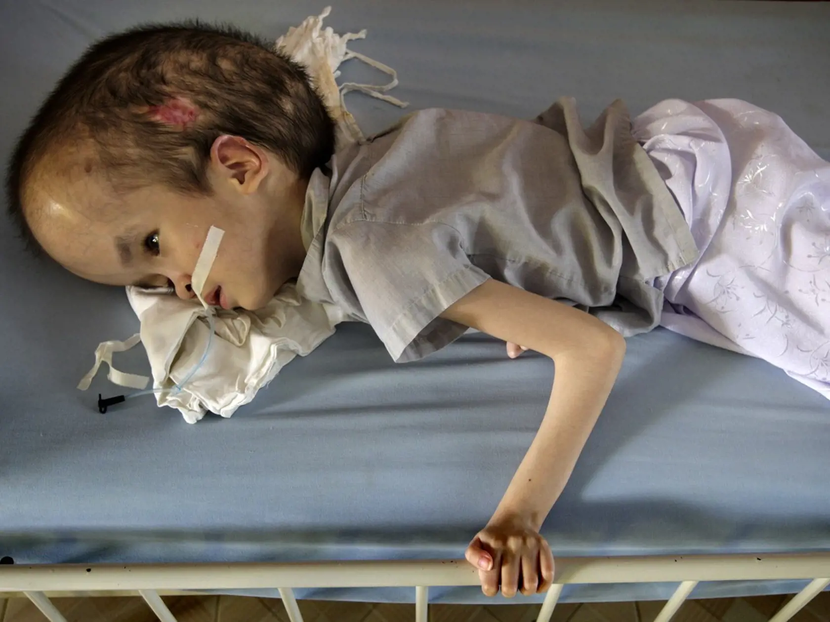 Mimoriadne nebezpečná zmes chemikálií, ktorá niesla kódové označenie „Agent Orange,“ slúžila na odlesňovanie a zabíjanie vegetácie v džungli, v ktorej sa ukrývali vietnamskí nepriatelia. Tieto herbicídy boli, samozrejme, nebezpečné nielen pre rastliny a vegetáciu, ale aj ľudí. Vojská USA napriek tomu zhodili na vietnamské územie až 70-tisíc ton tohto „Agenta Orange“.
