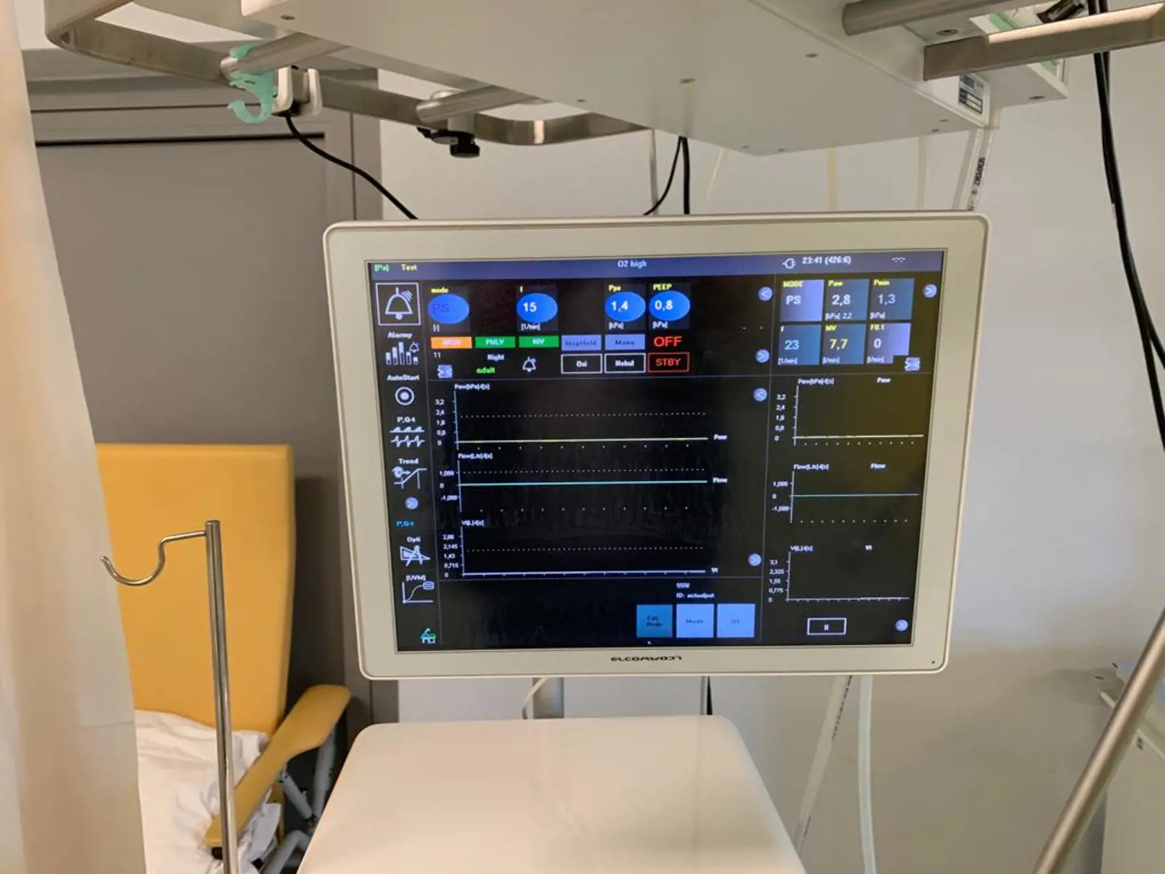 Na Slovensku sa podarilo skonštruovať prvý ventilátor na svete, ktorý umožňuje ventilovať s pľúca metódou Programovaná viac hladinová ventilácia pľúc s premenlivými tlakmi, objemami, časom a prietokmi.