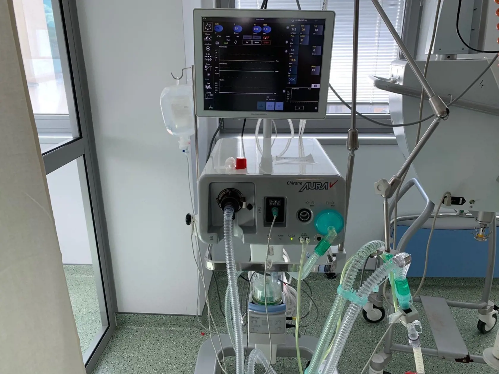 Na Slovensku sa podarilo skonštruovať prvý ventilátor na svete, ktorý umožňuje ventilovať s pľúca metódou Programovaná viac hladinová ventilácia pľúc s premenlivými tlakmi, objemami, časom a prietokmi.