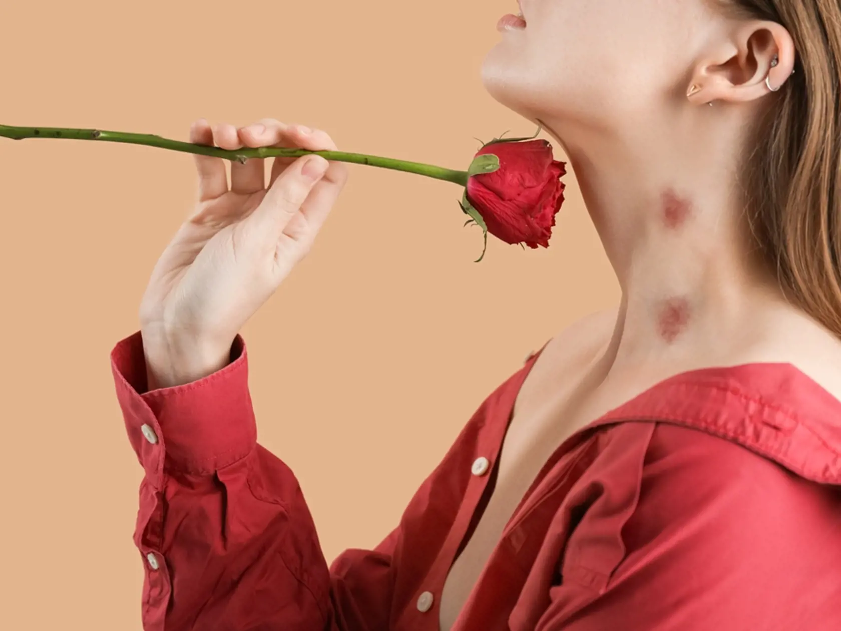 Young,Woman,With,Love,Bites,On,Her,Neck,Holding,Rose