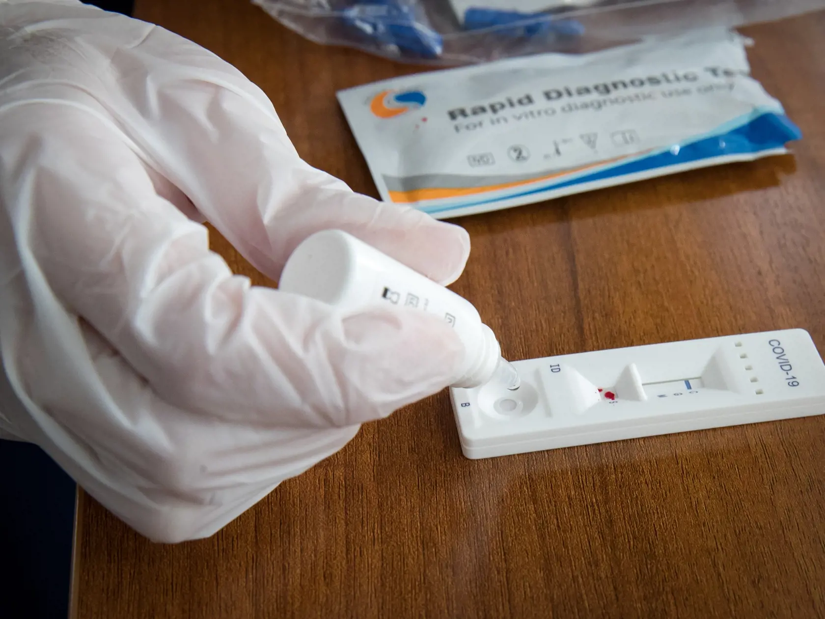 Rýchlotest COVID-19 IgG/IgM.
Test na protilátky, ktorý deteguje 2 druhy protilátok (IgG a IgM), ktoré tvorí ľudský organizmus v prípade kontaktu s vírusom SARS-CoV-2.