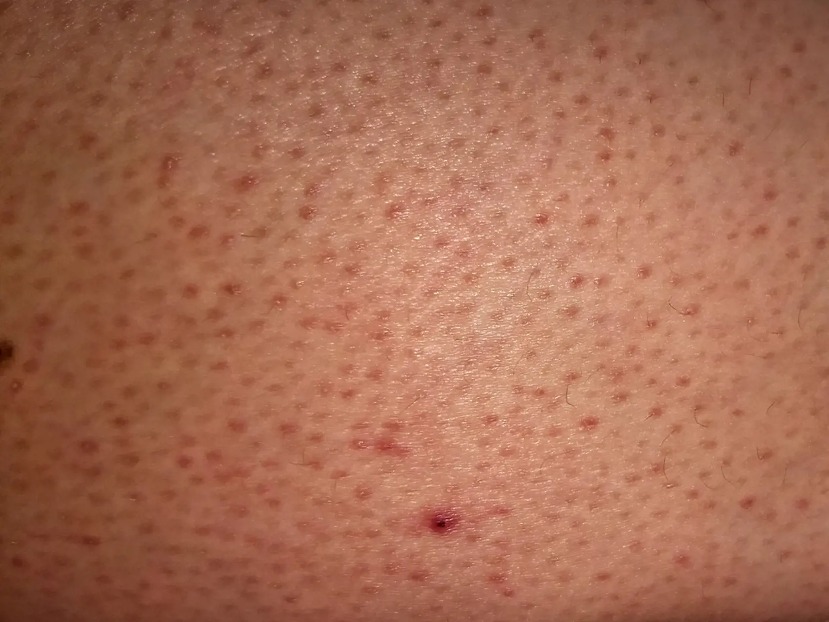 Jednoduchý recept na odstránenie jahodových nôh si raz dva pripravíte aj vo vašej kuchyni.