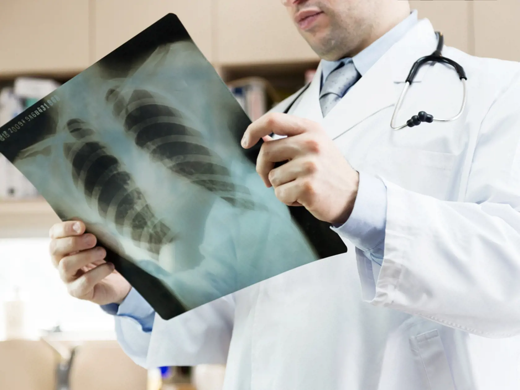Chronický zápal v pľúcach môže viesť k astme, chronickej obštrukčnej pľúcnej chorobe, chronickej bronchitíde, dýchavičnosti, hromadeniu tekutiny v pľúcach.