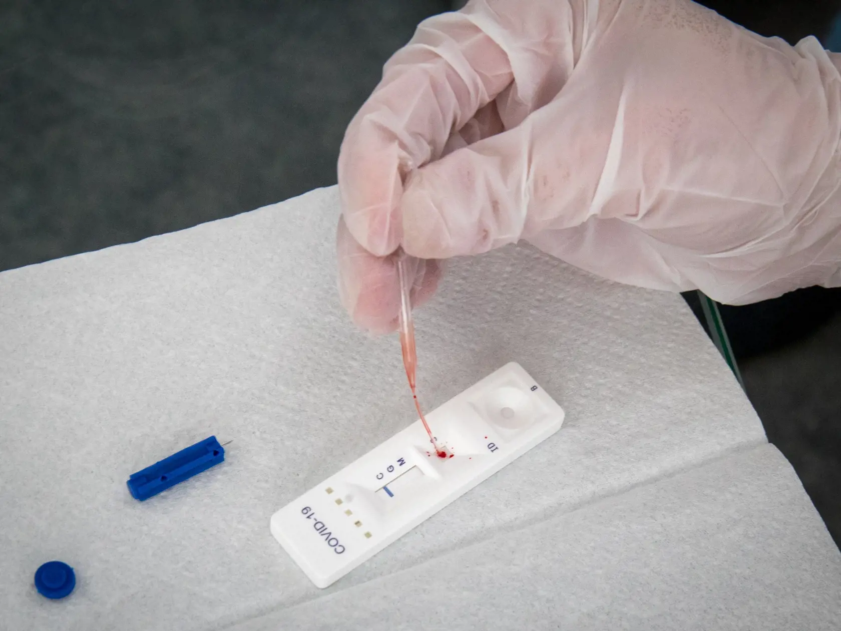 Rýchlotest COVID-19 IgG/IgM.
Test na protilátky, ktorý deteguje 2 druhy protilátok (IgG a IgM), ktoré tvorí ľudský organizmus v prípade kontaktu s vírusom SARS-CoV-2.