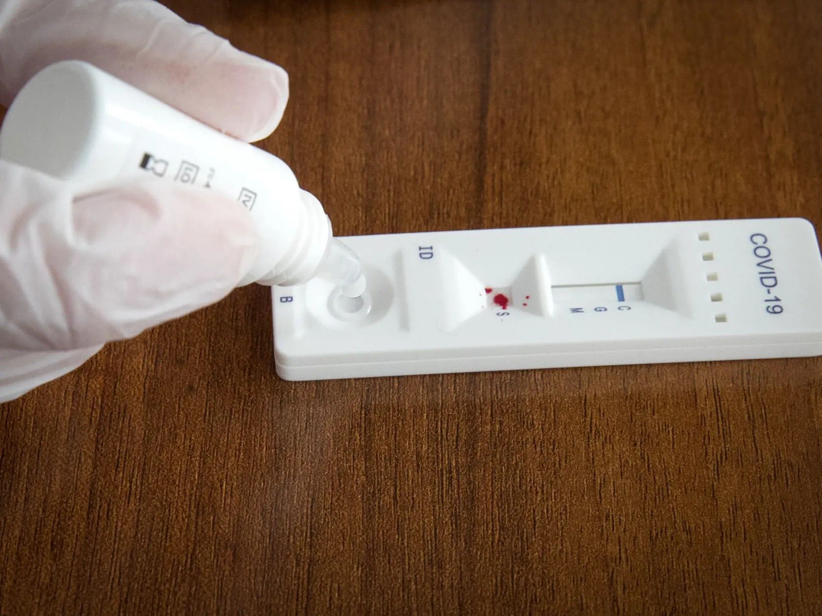 Rýchlotest COVID-19 IgG/IgM.
Test na protilátky, ktorý deteguje 2 druhy protilátok (IgG a IgM), ktoré tvorí ľudský organizmus v prípade kontaktu s vírusom SARS-CoV-2.