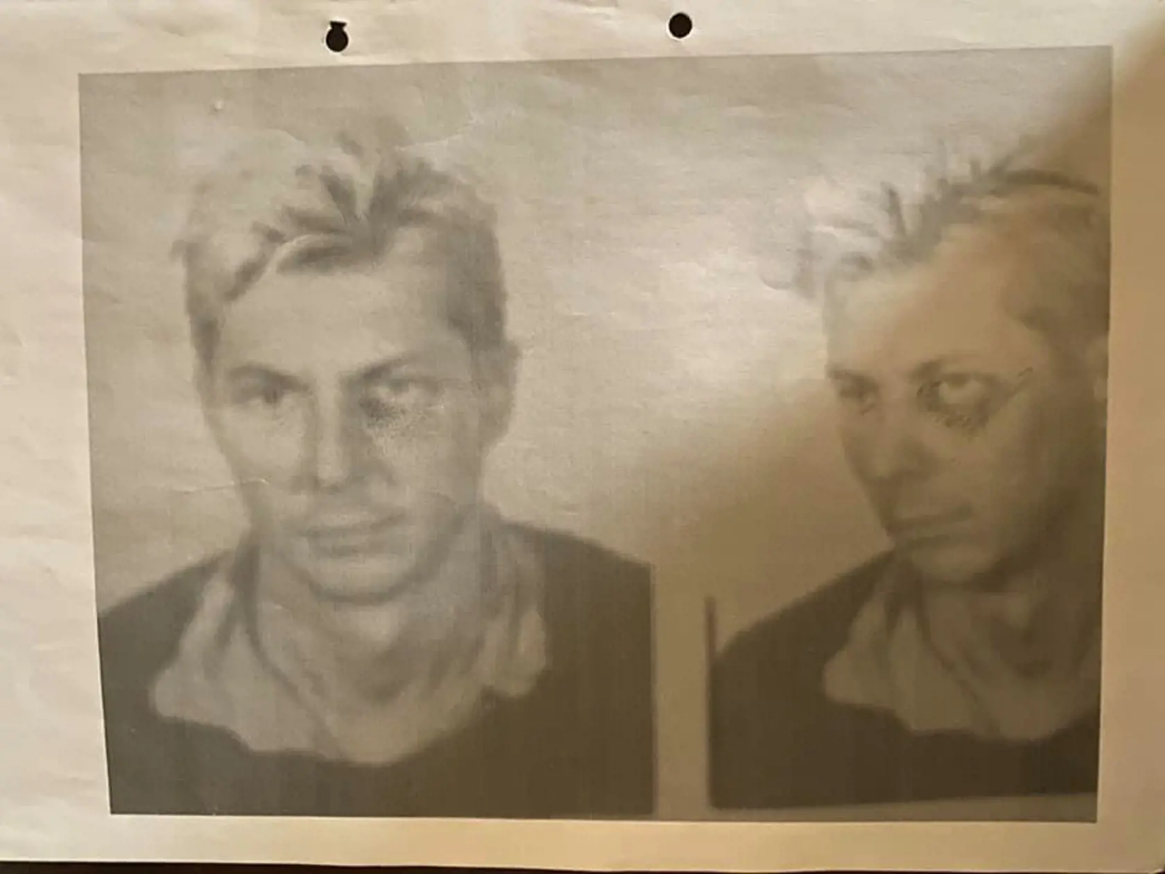Dobová fotka dobitého Ondreja Janíčka. Tvrdí, že mu naložili policajti pri zatýkaní.