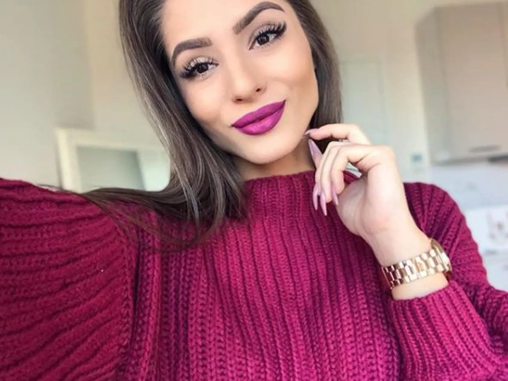 Česká youtuberka Kristýna Třešňáková alias Týnuš utrpela popáleniny na 35% tela.