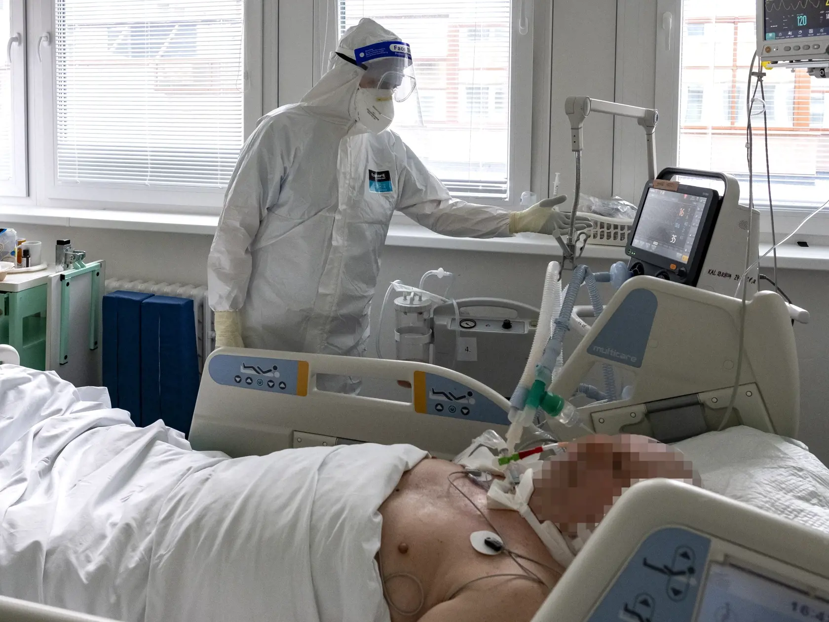Umelá pľúcna ventilácia je posledná záchrana pri pacientoch, ktorí sa dusia.