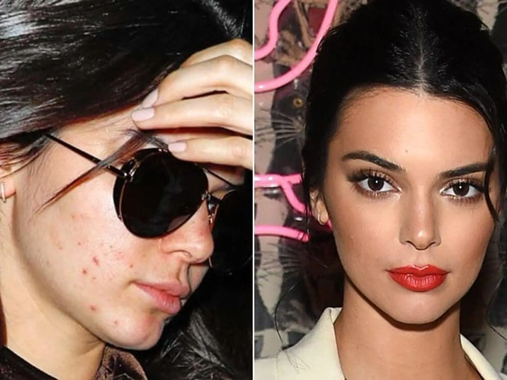 Instagramová celebrita a modelka Kendall Jenner dokáže kozmetikou zakryť problémovú pleť perfektne.