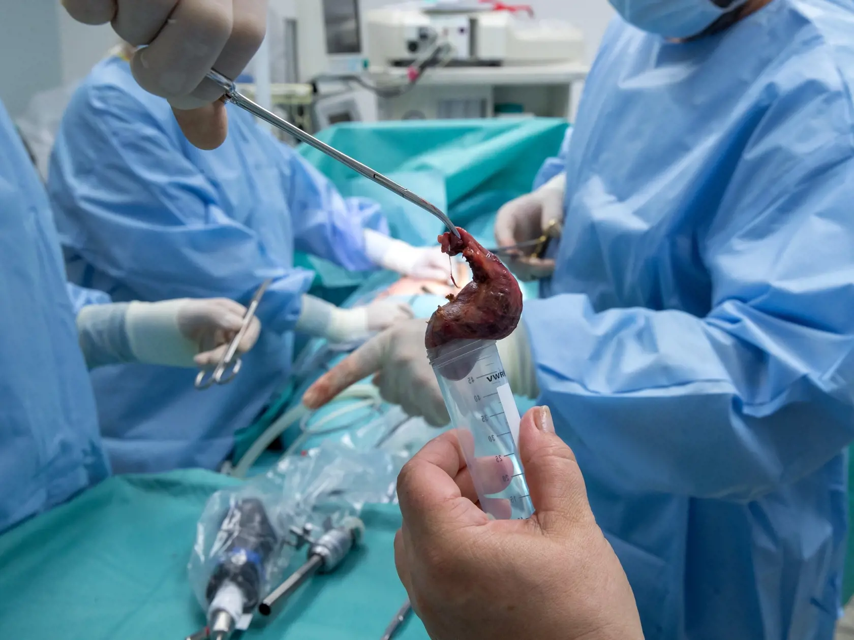 Laparoskopická operácia odstránenia žlčníka na klinike jednodňovej chirurgie REVIVE v Bratislave.