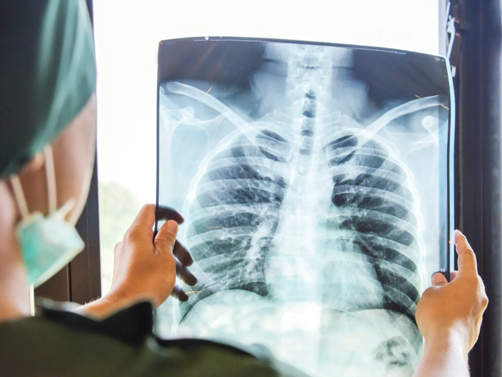 Kašeľ je jedným z najčastejších symptómov, ktoré sú príčinou vyšetrenia pacienta lekárom predovšetkým v ambulantnej zdravotnej starostlivosti.