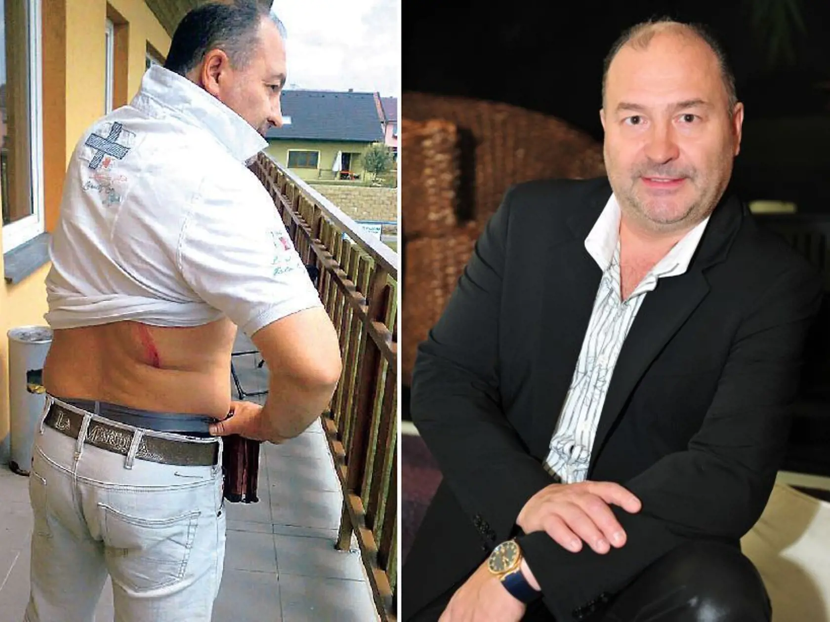 Michal David sa nepríjemne zranil počas
