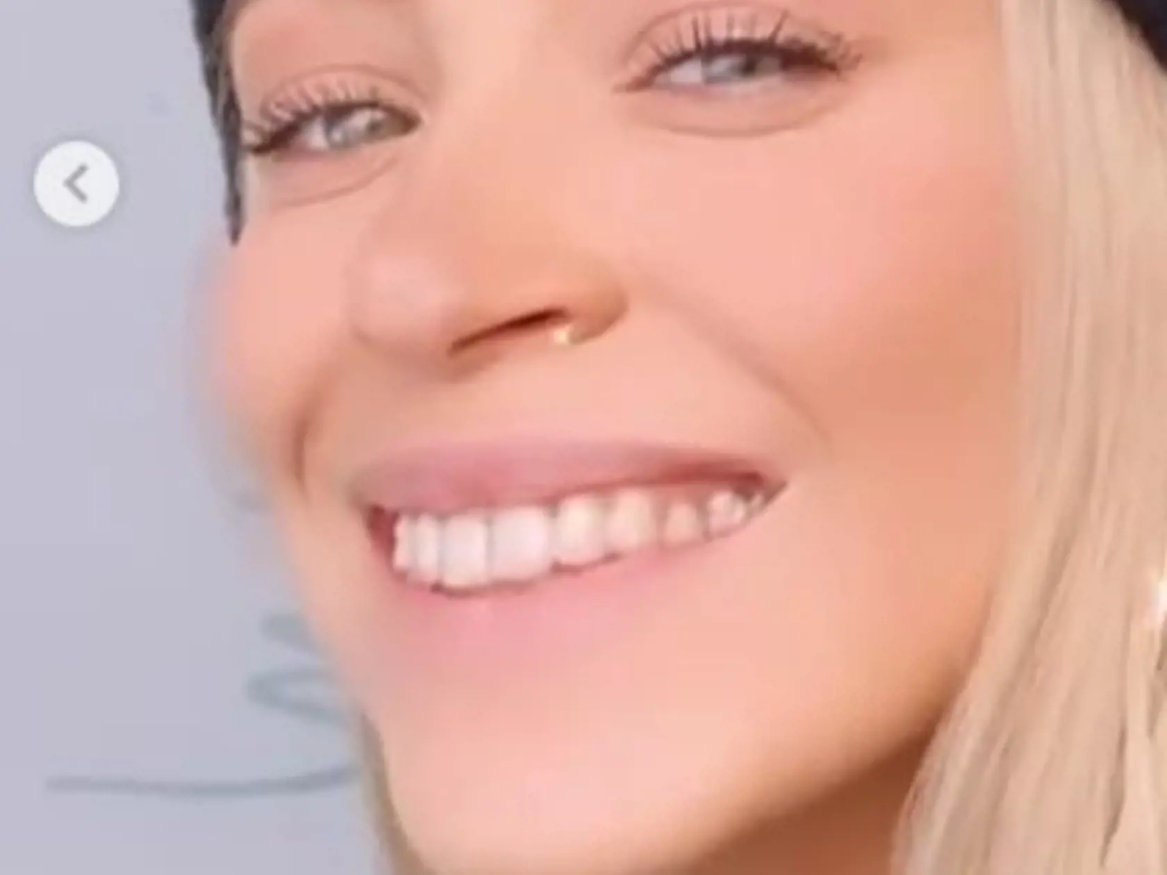 Dominika Mirgová si dala vylepšiť úsmev.
