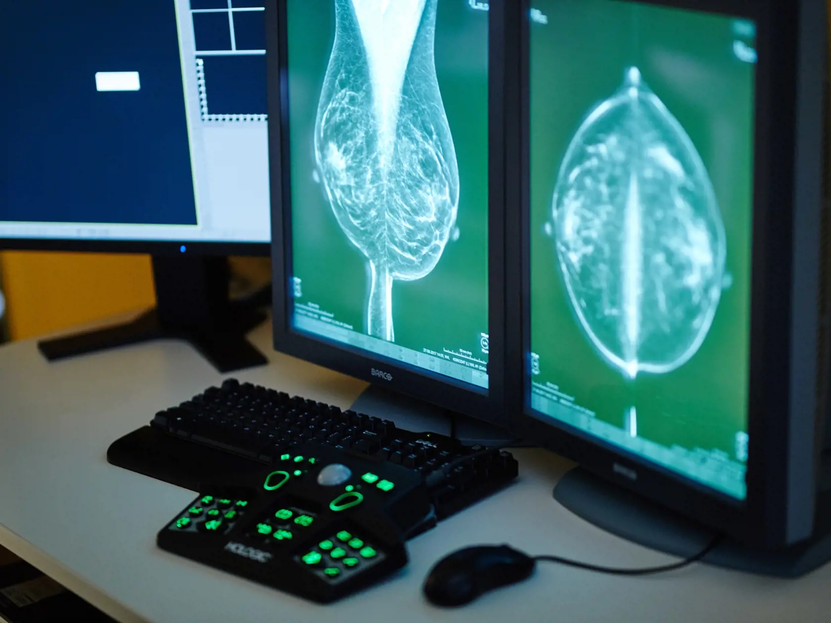 Umelá inteligencia: IBM Watson for Oncology s lekárom naozaj komunikuje, aj keď zatiaľ nie hlasom.