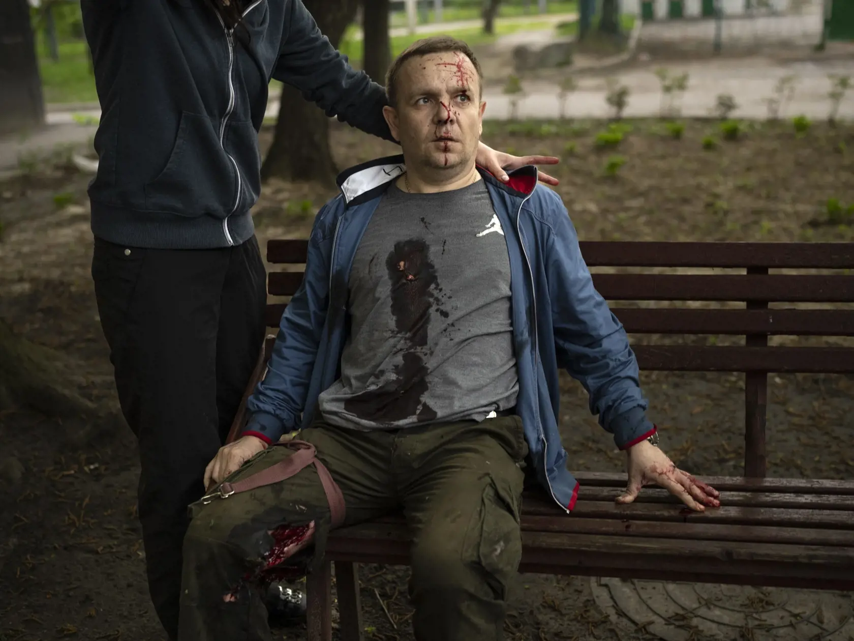 WA 53 Charkov - Zranený muž sedí na lavičke a čaká na záchranárov po ruskom bombardovaní v meste Charkov v stredu 27. apríla 2022. FOTO TASR/AP     

An injured man waits for emergency workers following a Russian bombardment in Kharkiv, Ukraine, Wednesday, April 27, 2022. (AP Photo/Felipe Dana)