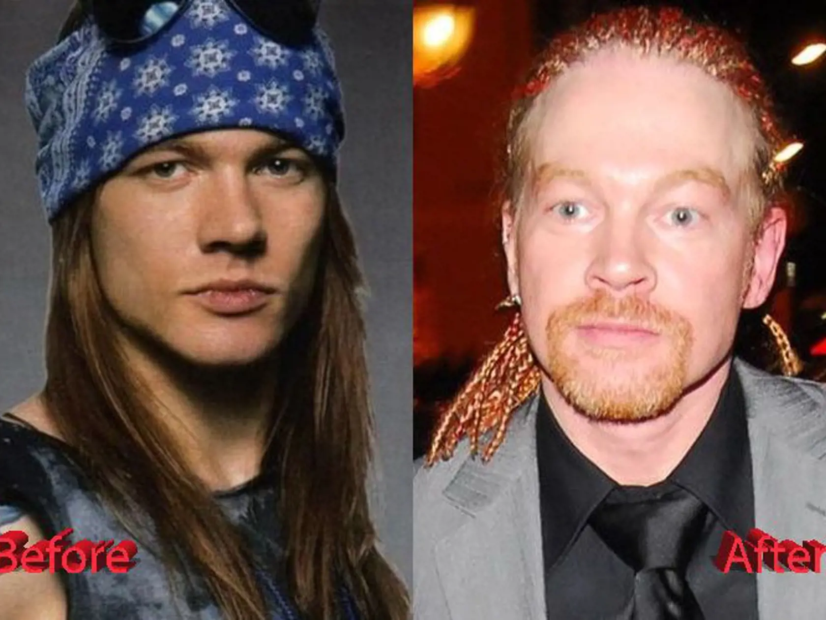 Axl Rose