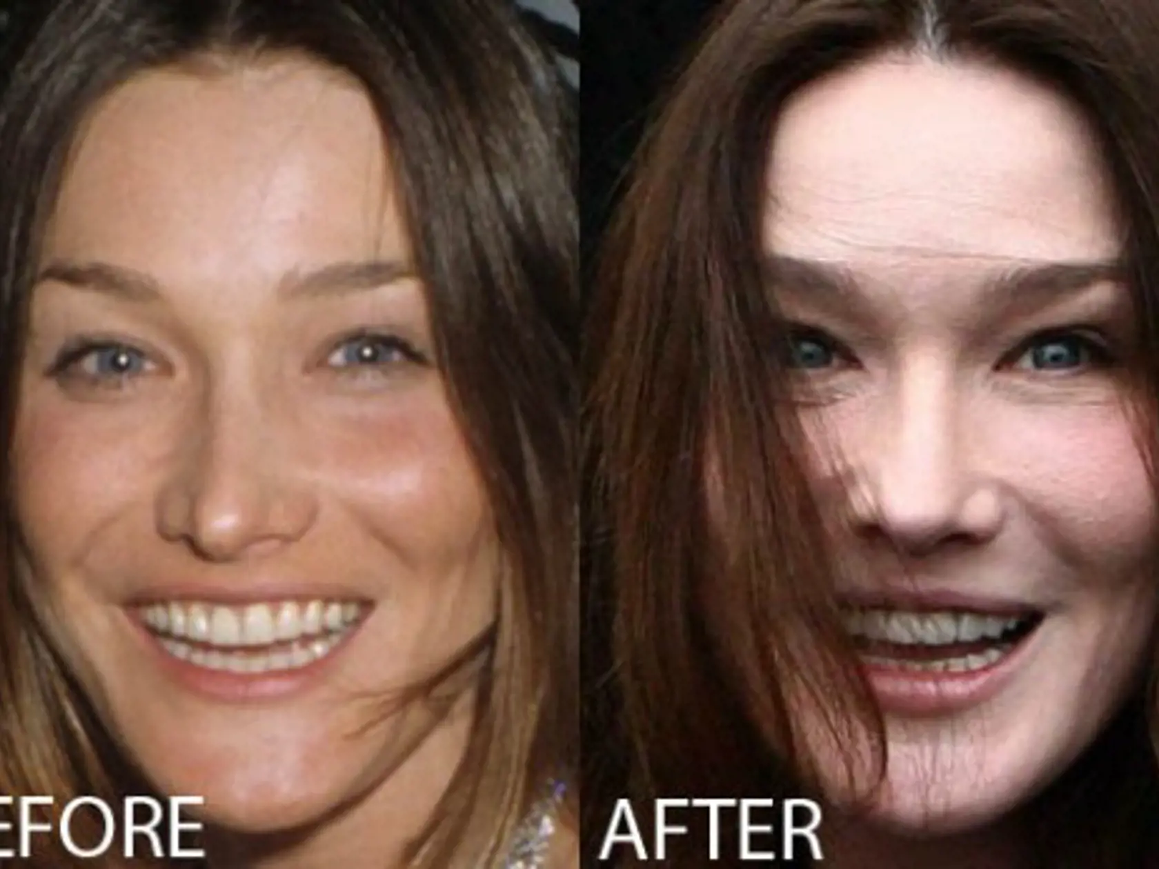 Carla Bruni