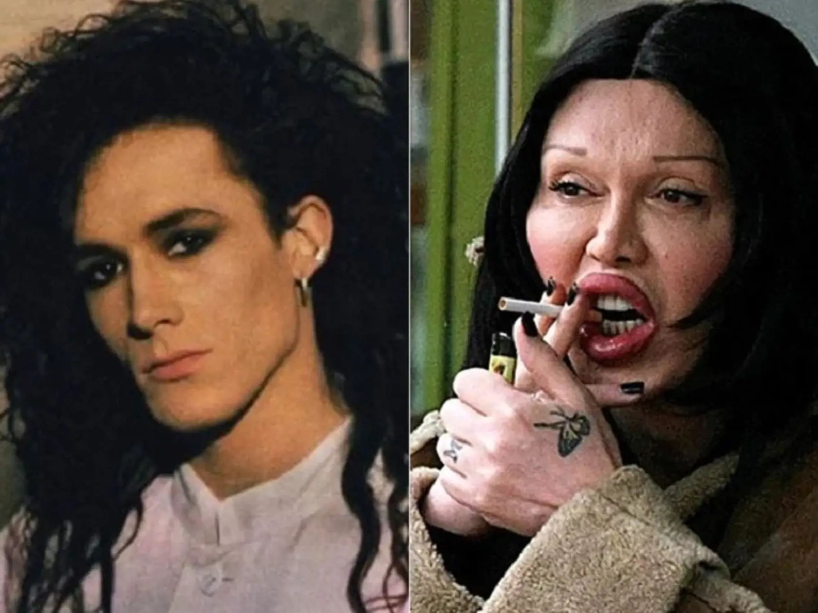Pete Burns
