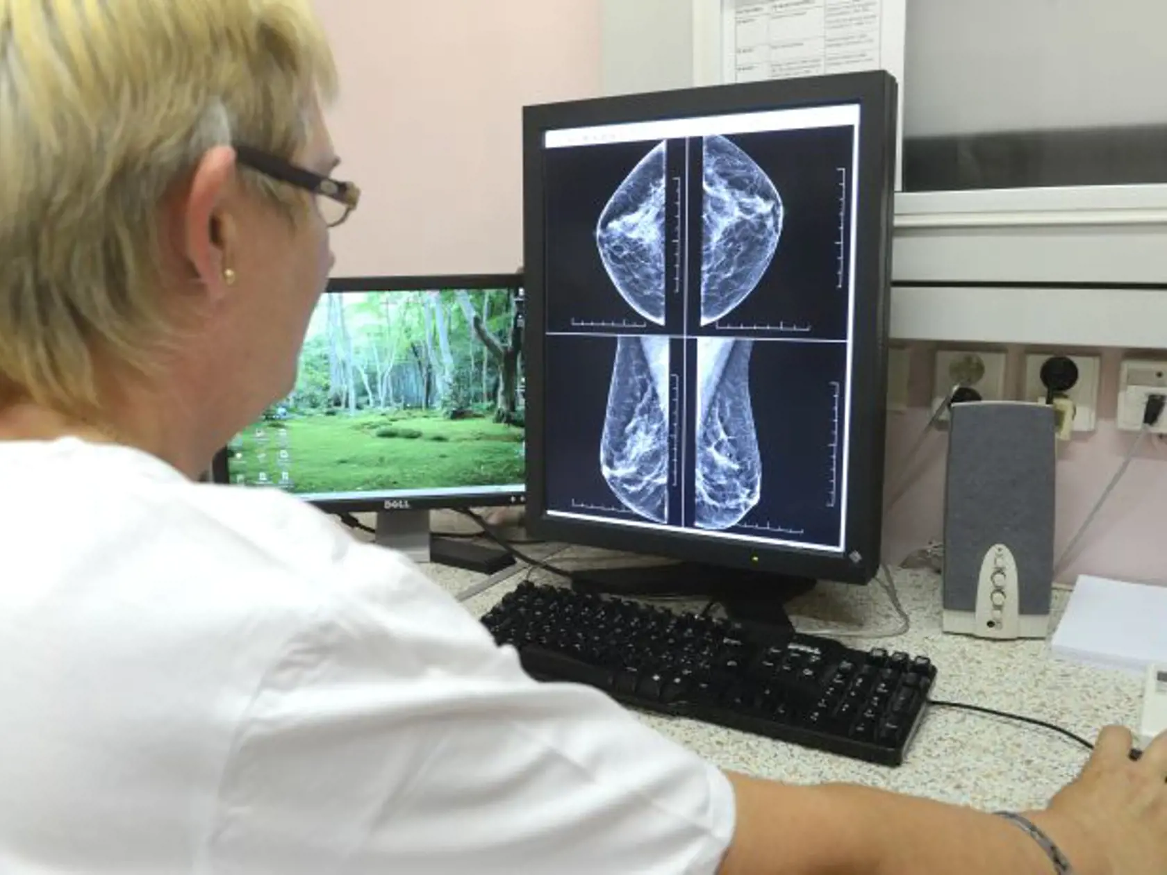 V  Nemocnici Košice - Šaca a.s. 1. súkromná nemocnica odovzdali do užívania  nový mamograf. Jeho technické parametre umožnili zvýšiť kvalitu snímok. Na obrazoch, prenesených z prístroja priamo na diagnostický  monitor počítača, vie lekár rádiológ nájsť aj tie najmenšie chorobné zmeny, ktoré môžu predstavovať vývoj závažného ochorenia prsníkov.