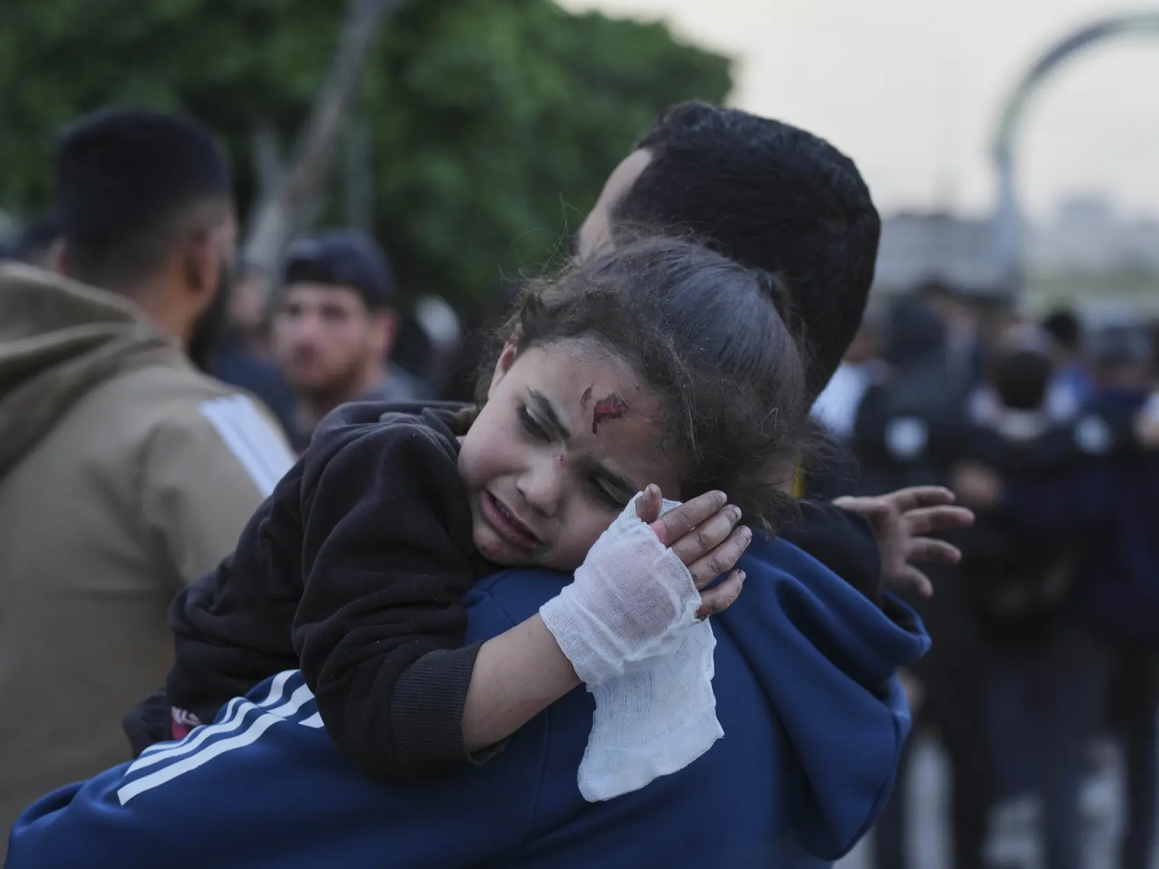 JB 34 Gaza - Palestínske dievčatko zranené po izraelských leteckých útokoch prinášajú na ošetrenie do nemocnice v meste Gaza 3. apríla 2025. Najmenej 25 ľudí prišlo v Pásme Gazy vo štvrtok o život pri izraelskom leteckom útoku na budovu školy, ktorá slúži ako útočisko pre ľudí vysídlených v dôsledku vojny, uviedla tamojšia civilná obrana. TASR informuje podľa agentúry AFP. Podľa hovorcu gazského úradu pre civilnú obranu Mahmúda Bassala došlo k náletu severovýchodne od mesta Gaza a zranenia utrpelo najmenej ďalších 100 osôb. FOTO TASR/AP

A young Palestinian girl who was injured in an Israeli airstrike, is brought for a treatment at the Baptist Hospital in Gaza City, on Thursday, April 3, 2025. (AP Photo/Jehad Alshrafi)