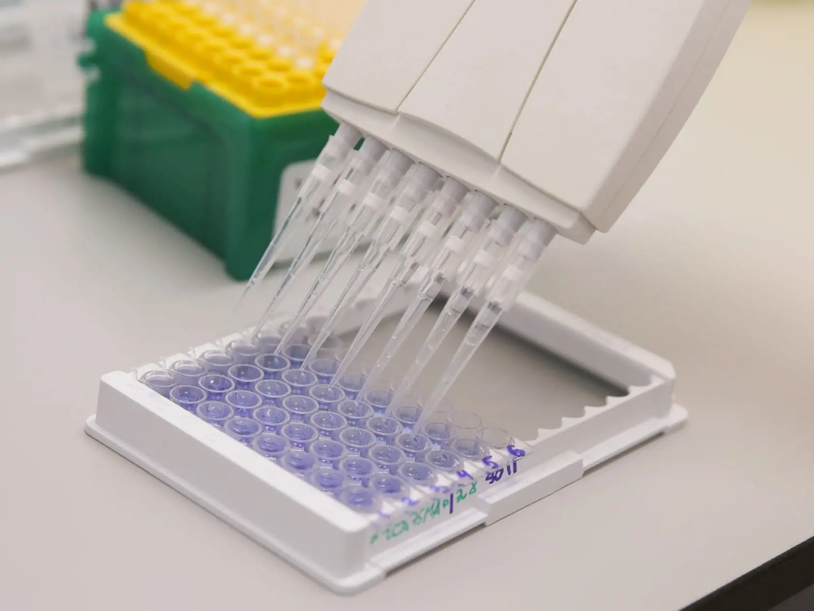 Vývin vakcíny proti Covid-19 v ústave epidemiologického a mikrobiologického výskumu Nikolaja Gamaleja v Moskve.