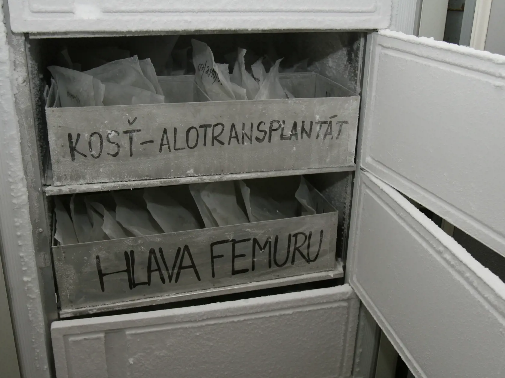 Centrálna tkanivová banka - Nemocnica Ružinov - transplantáty - skladovanie

31.01.2008 Bratislava
foto: Matej Kalina
pôvodný súbor:IMG_foto Matej Kalina_22723.JPG
