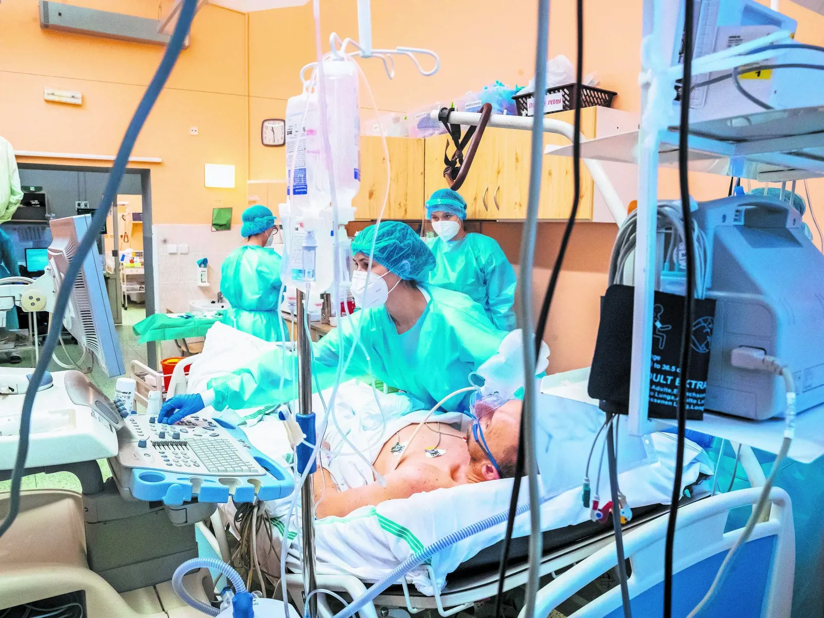 Anesteziológov počas druhej vlny potrebovali v nemocniciach pri covidových lôžkach pacientov na pľúcnej ventilácii. Dnes už je epidemická situácia dobrá a vraciame sa do normálu. Tisíce pacientov však na svoju operáciu ešte čakajú.