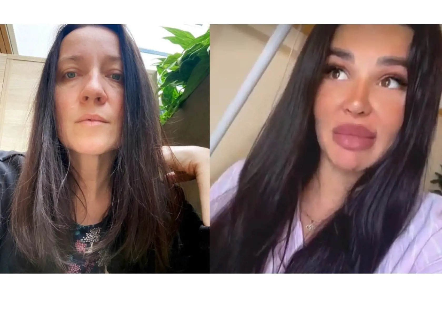 Koščová vs Plačková: Influencerka Zuzana Strausz Plačková ponúka kolagén spolu s Jasminou Alagič. Jedna škatuľa stojí 35 eur. „Kamoši, skúste namiesto kupovania kolagénu sledovať ozaj vzdelaných ľudí,“ vyzvala speváčka otvorene na sociálnej sieti.
