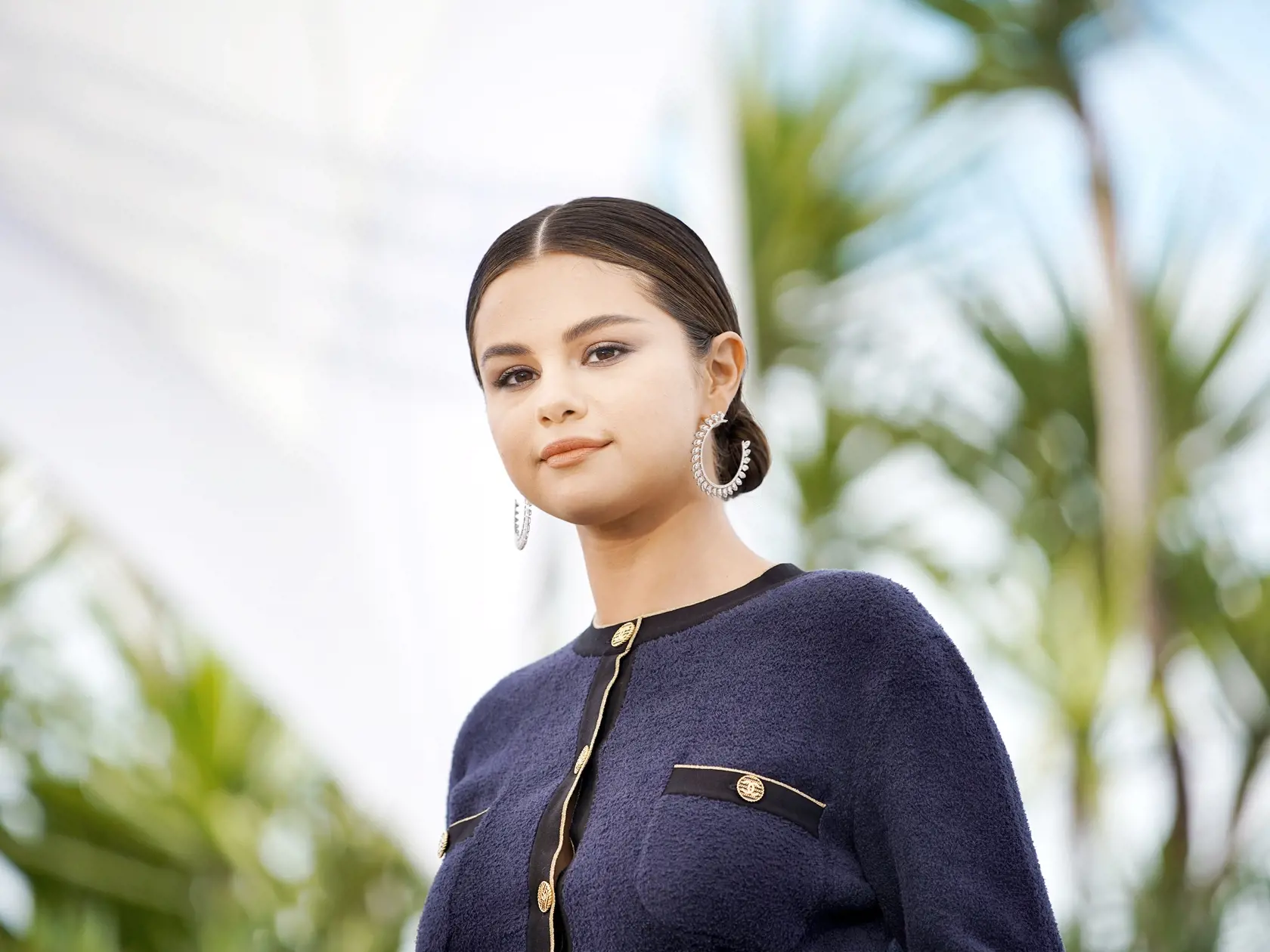 Selena Gomez sa trápi s chorobou lupus.