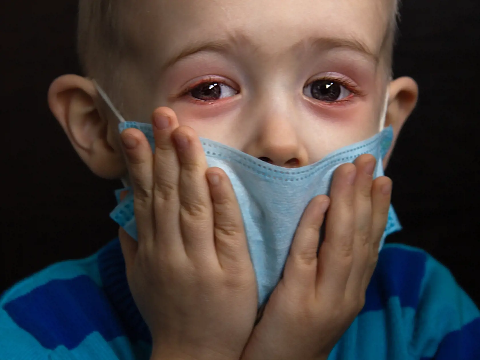 Sick,Child,With,Red,Eyes,In,A,Protective,Mask.,Young