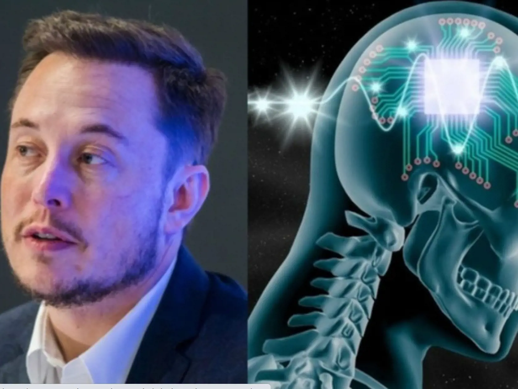 Americké úrady dali súhlas na testovanie mozgových implantátov na ľuďoch