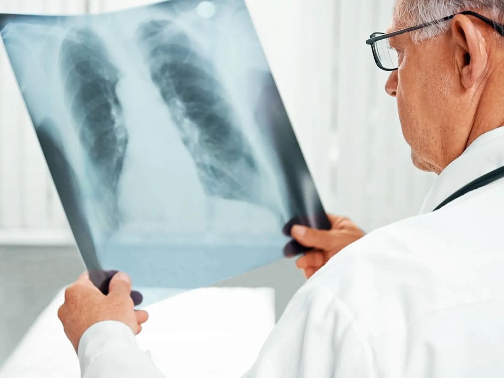 K základným metódam vyšetrenia patrí tuberkulínová skúška a röntgen.