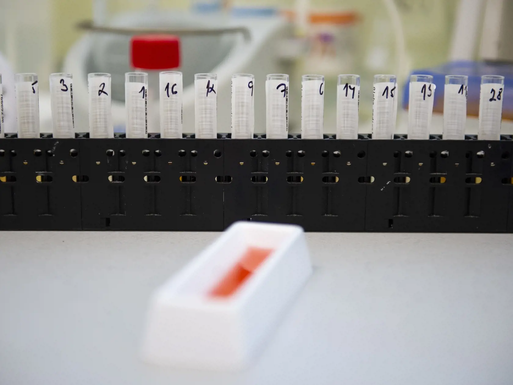 Spoločnosť Alpha medical testuje sérum z odobratej krvi pacienta. Odber je realizovaný ambulantne a ide o krv zo žily, nie kapilárnu krv z prsta (ako pri rýchlotestoch). Test prebieha v laboratóriu na platničke, ktorá je potiahnutá požadovaným vírusovým proteínom – antigénom. Vzorky pacientov sa potom s antigénom inkubujú a ak má pacient protilátky proti vírusovému antigénu, viažu sa spolu. Naviazaný komplex protilátka-antigén sa potom môže detegovať ďalším premytím protilátok, ktoré vytvárajú f