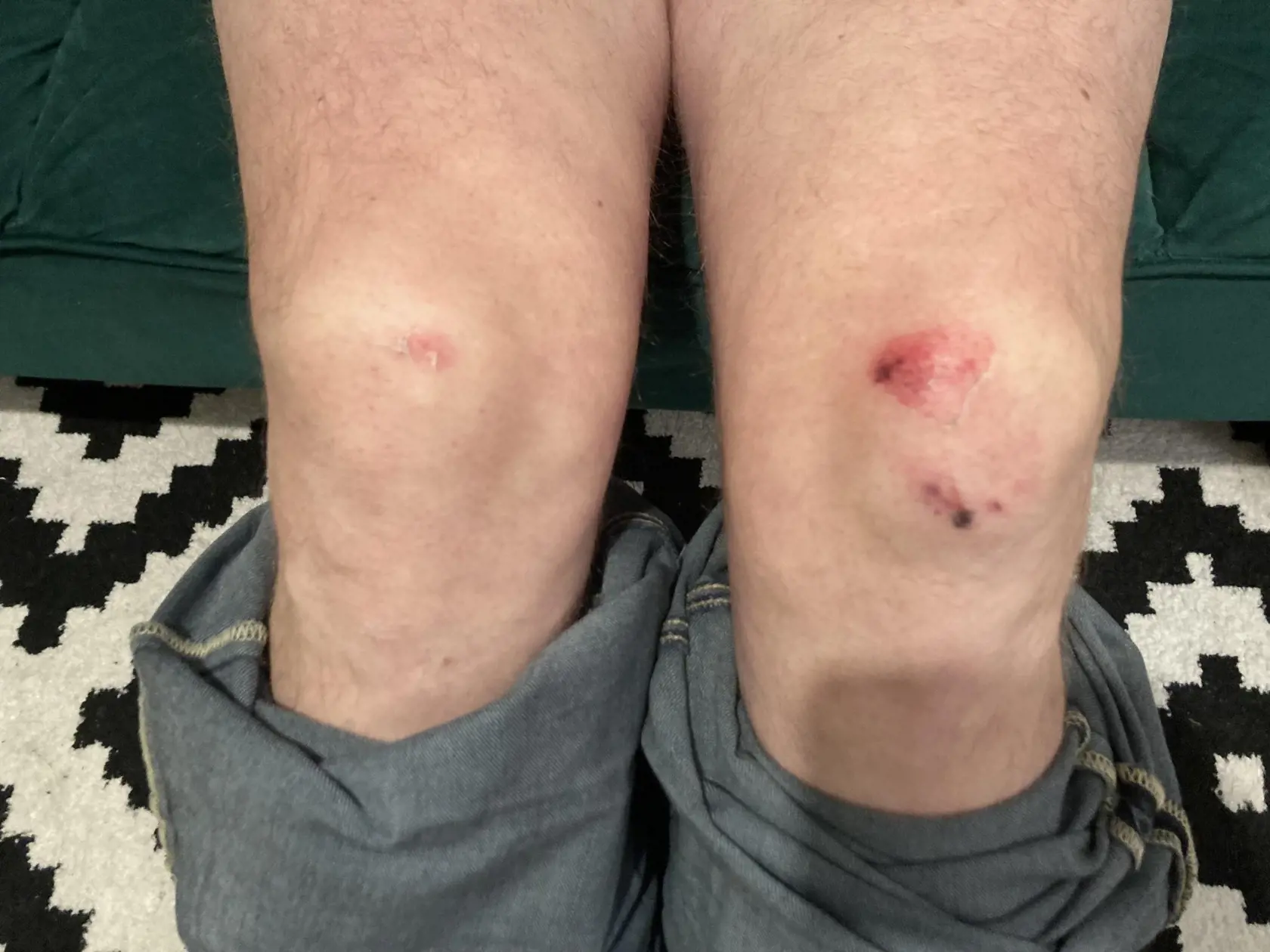 Zranenia pána Vlastimila po brutálnom policajnom zákroku.