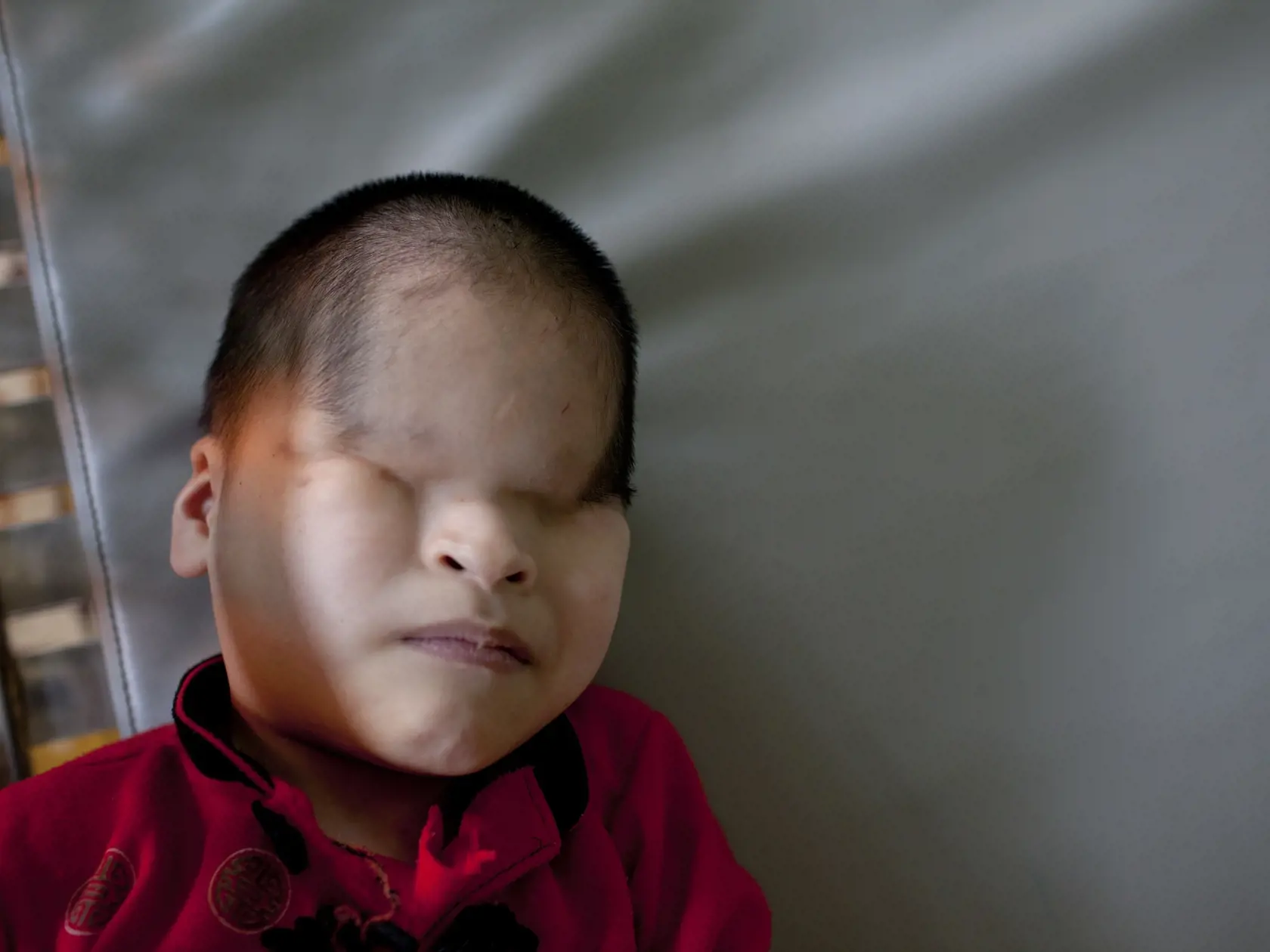 Tisíce vietnamských civilistov, vojakov a veteránov utrpeli vážne zdravotné problémy v dôsledku expozície Agent Orange. Mnohí z nich trpia zhubnými nádormi, poruchami imunitného systému a neurologickými poruchami. Genetické mutácie zasiahli mnoho detí narodených po vojne, ktoré majú postihnuté fyzické a mentálne schopnosti.