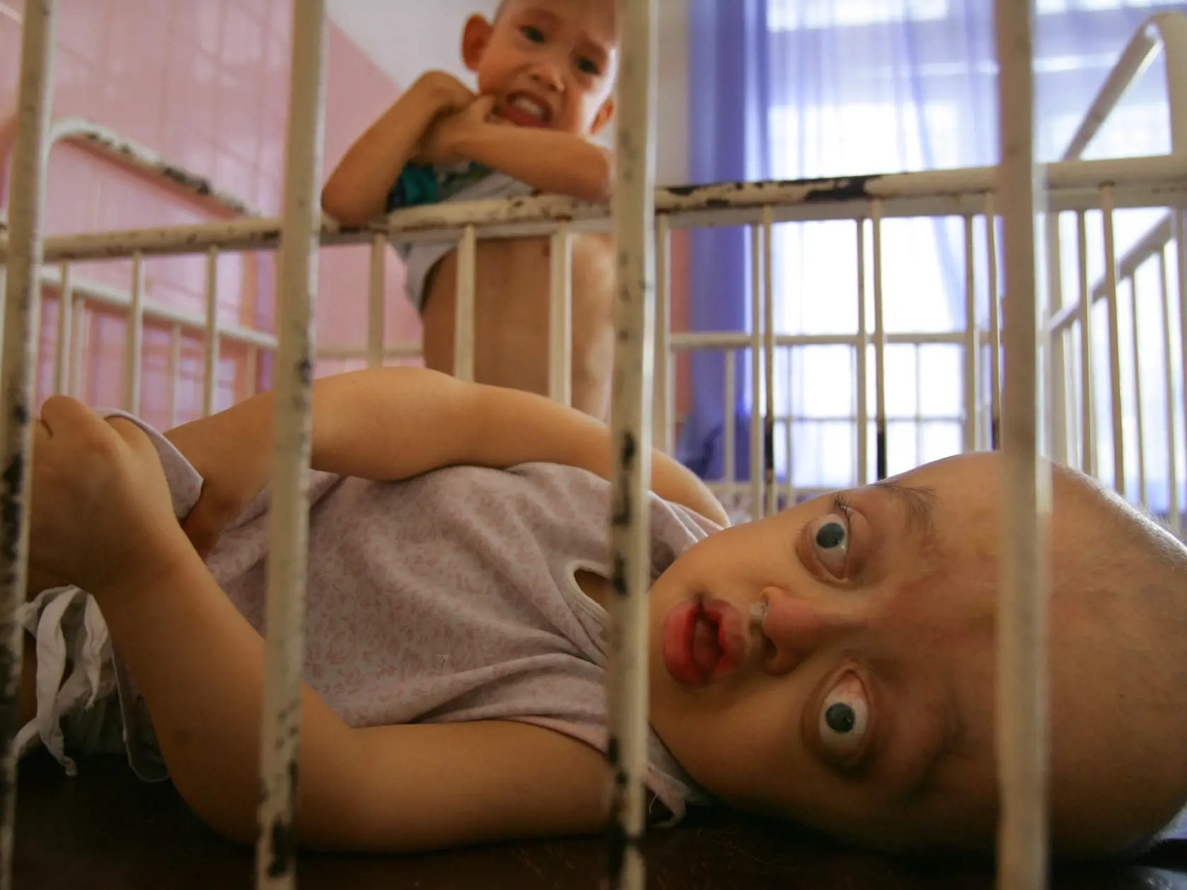 Desivé následky vojny vo Vietname trvajú dodnes. Potom, čo Amerika vypustila chemickú zbraň s názvom Agent Orange sa dodnes rodia deti s genetickou poruchou.