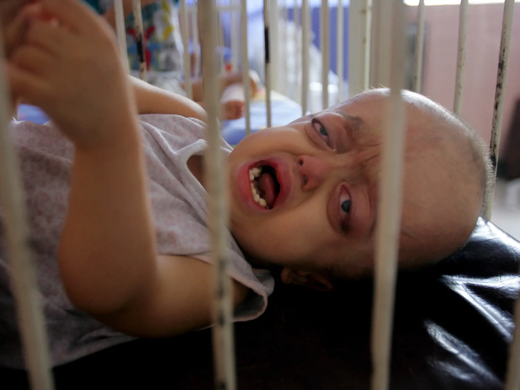 Desivé následky vojny vo Vietname trvajú dodnes. Potom, čo Amerika vypustila chemickú zbraň s názvom Agent Orange sa dodnes rodia deti s genetickou poruchou.