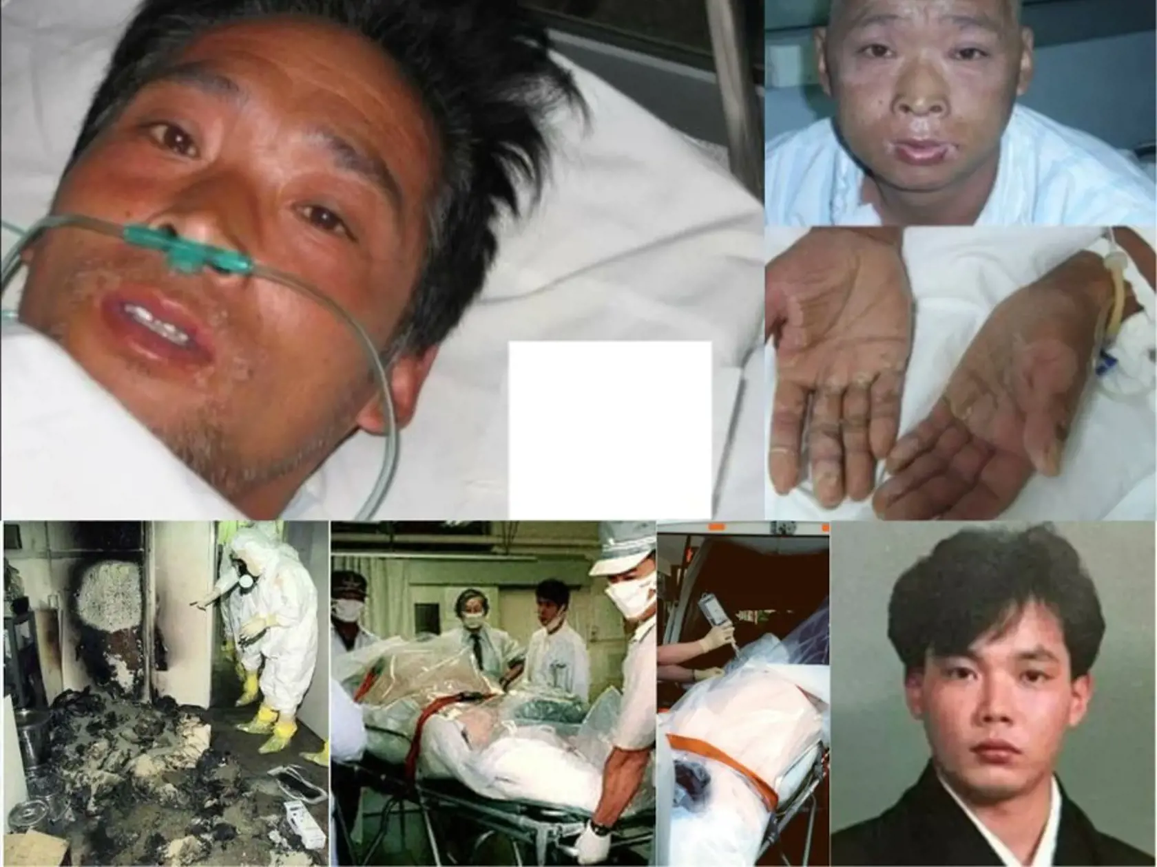 Desivý a bolestivý osud postihol Hisashiho Ouchiho, pracovníka na experimentálnom reaktore v japonskej prefektúre Ibaraki. Ouchi a dvaja spolupracovníci boli požiadaní, aby zmiešali 2,4 kilogramu uránu s kyselinou dusičnou, pričom ignorovali bezpečnostné postupy a zmiešali ho vo vedre z nehrdzavejúcej ocele.