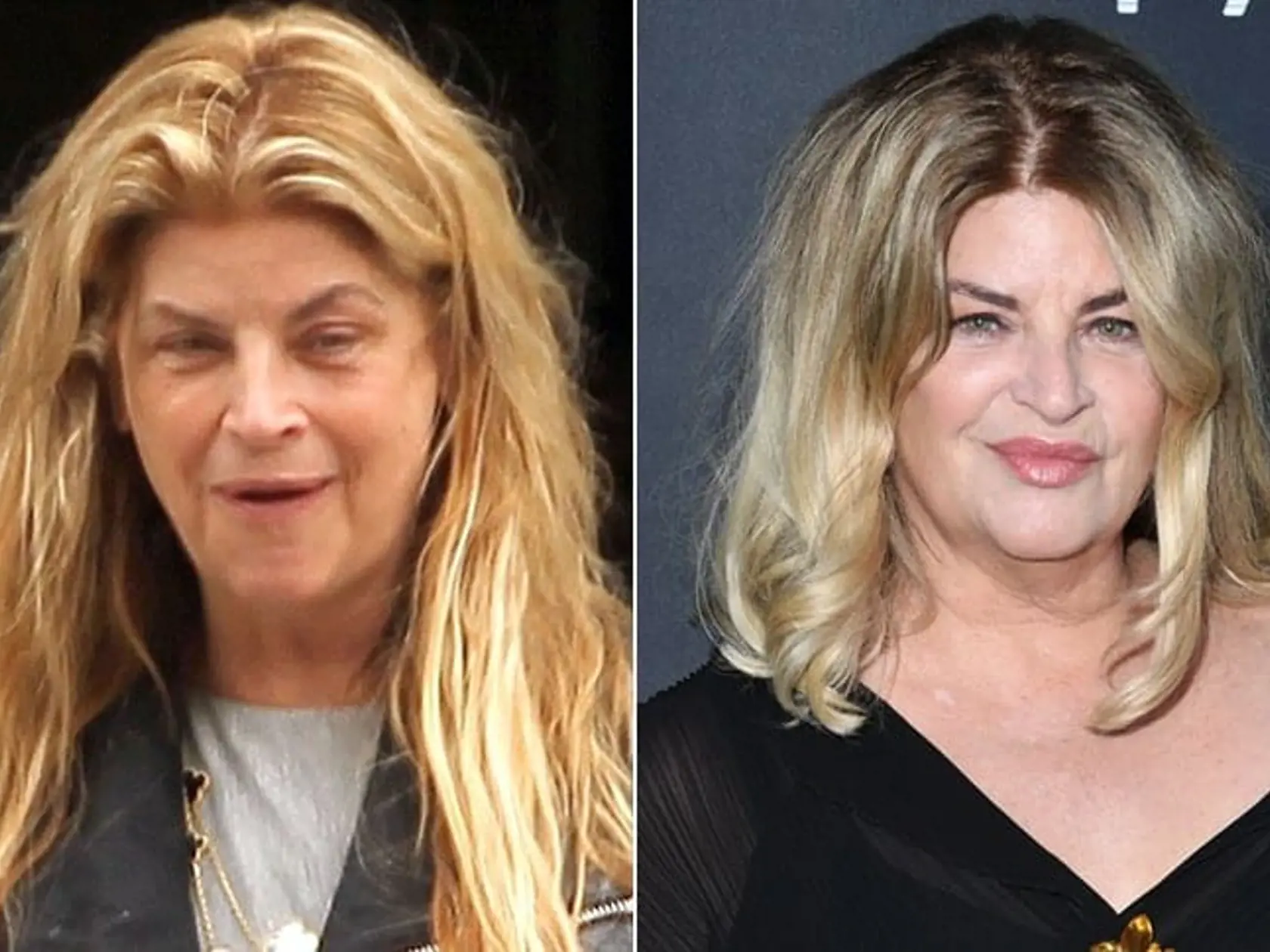Kirstie Alley bola uznávanou herečkou. Vo veku 71 rokov podľahla rakovine, no šarm si udržala do vysokého veku.