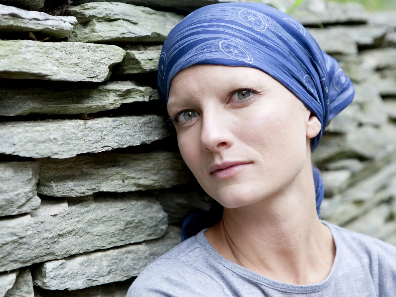 Serious Woman with Cancer