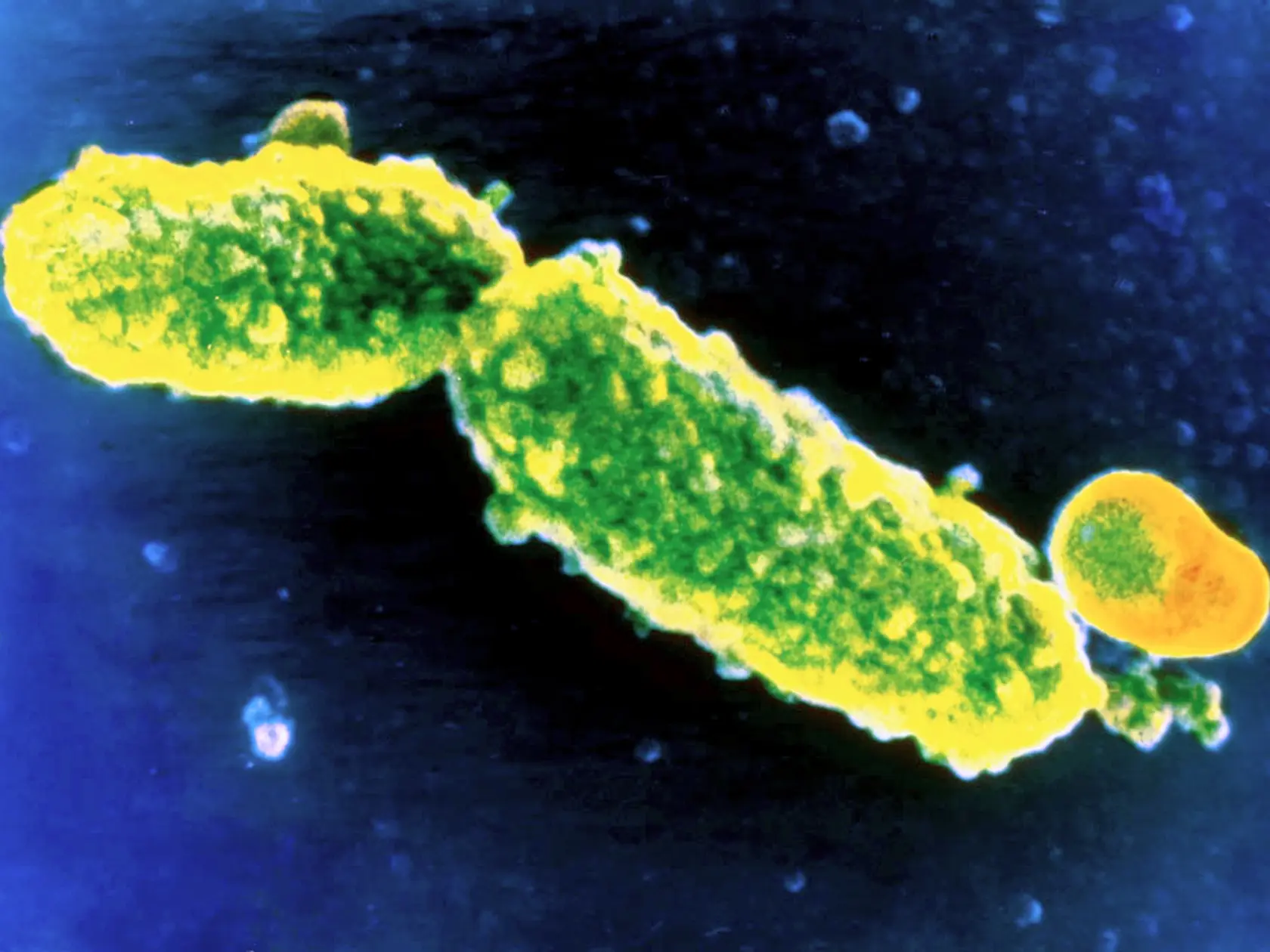 Toto je ona. Baktéria čierneho kašľa  Bordetella pertussis. Šíri sa kvapôčkami, ktoré sa dostanú na sliznice zdravých ľudí.