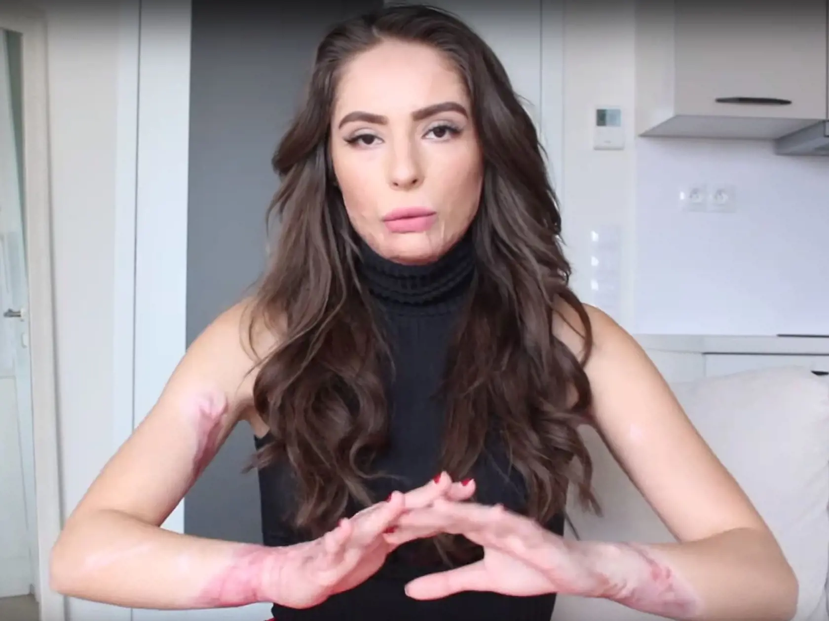 Česká blogerka Týnuš zverejnila prvé video od svojej hrôzostrašnej nehody v Istanbule.