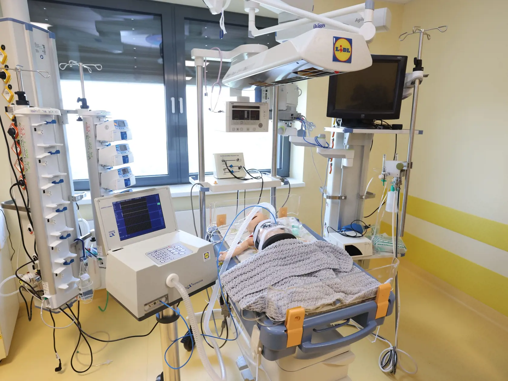 Jedným z prístrojov je ventilátor s negatívnym podtlakom.