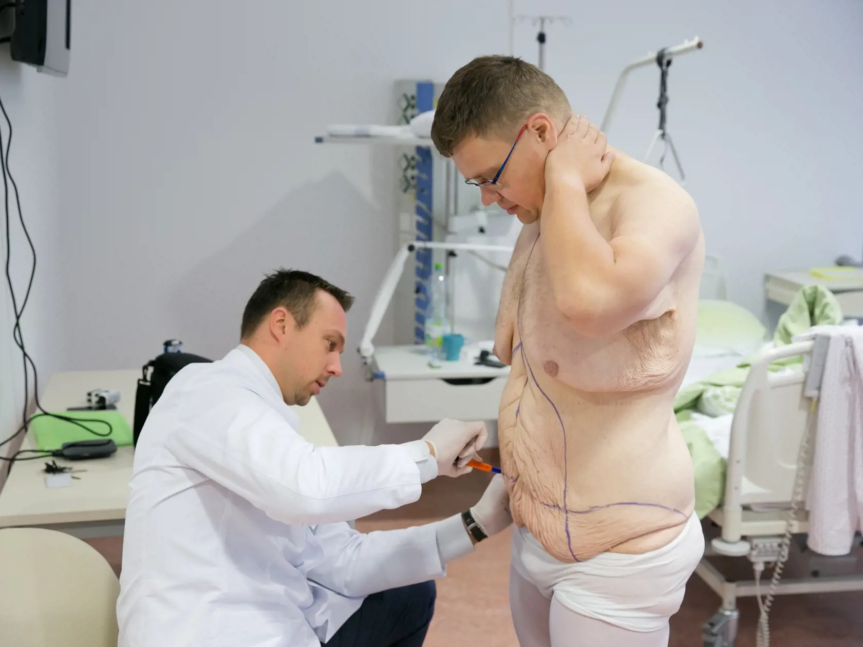 Ján Hodoň pred operáciou, keď ho lekár zbavil ovisnutej kože.